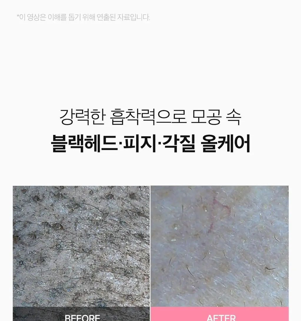 [피지뽑는] 에이프릴스킨 트라넥삼산 딥클렌저 120g 기획 (+15g 미니어처) 상세페이지 36